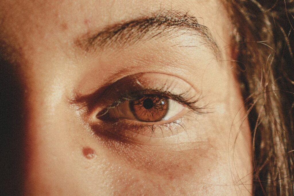 close up of freckles